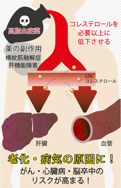 No.11 高脂血症（脂質異常症）の薬で病気の原因に？！【医食同源】 | HERBA