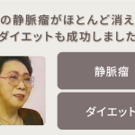 足の静脈瘤がほとんど消え、ダイエットも成功！