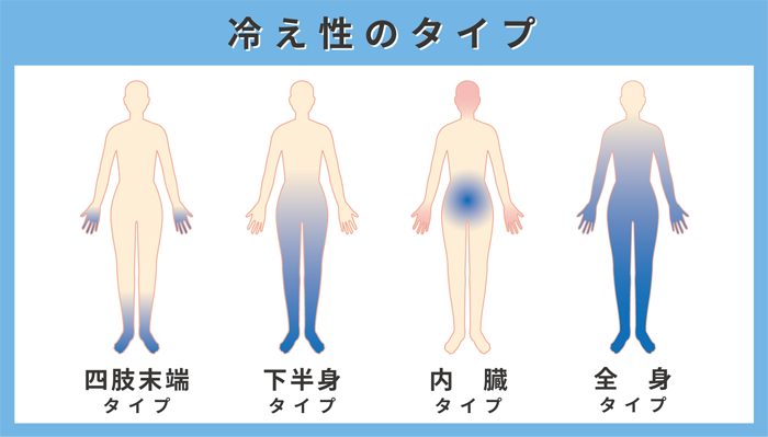 冷え性のタイプ